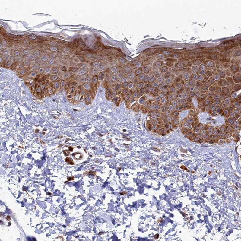 VPS34 Antibody - BSA Free Immunohistochemistry-Paraffin: VPS34 Antibody - BSA Free [NBP1-86862]