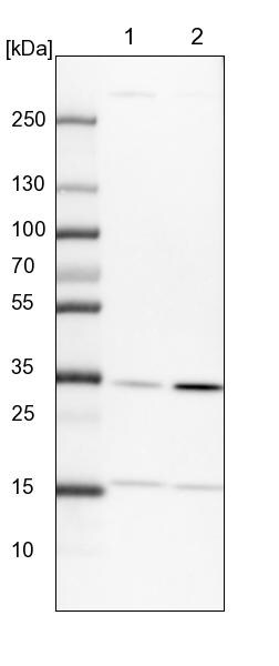 PITPNB Antibody - BSA Free Western Blot: PITPNB Antibody - BSA Free [NBP1-86864]