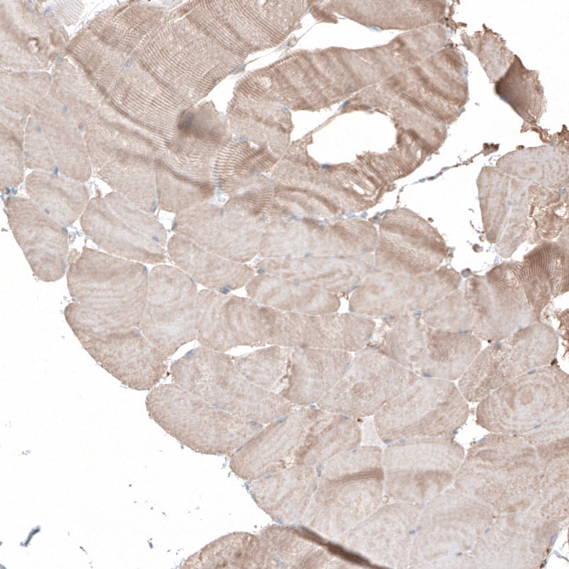Neuropilin-2 Antibody - BSA Free Immunohistochemistry: Neuropilin-2 Antibody - BSA Free [NBP1-86866]