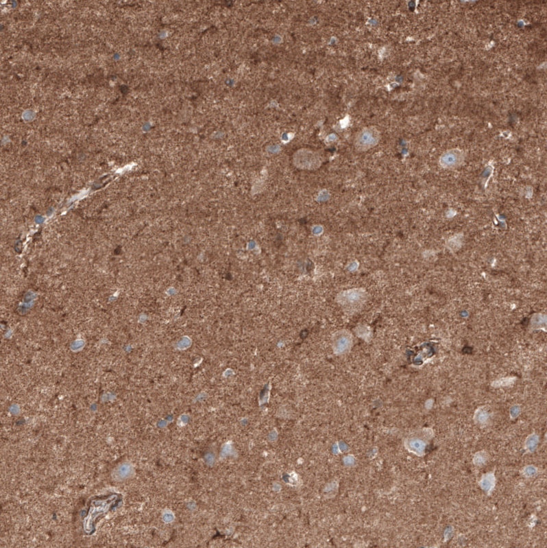 Neuropilin-2 Antibody - BSA Free Immunohistochemistry: Neuropilin-2 Antibody - BSA Free [NBP1-86866]