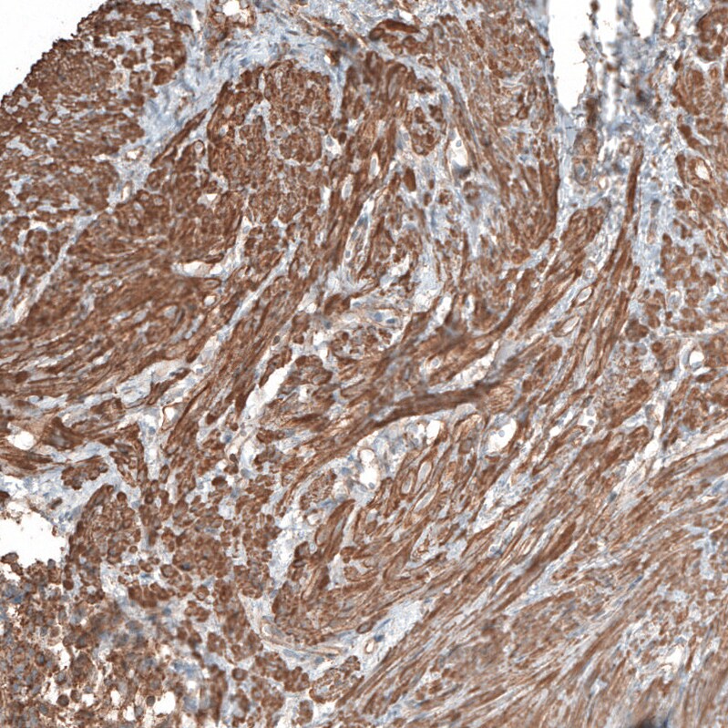 Neuropilin-2 Antibody - BSA Free Immunohistochemistry: Neuropilin-2 Antibody - BSA Free [NBP1-86866]