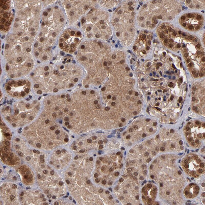 Cullin 5 Antibody - BSA Free Immunohistochemistry-Paraffin: Cullin 5 Antibody - BSA Free [NBP1-86868]