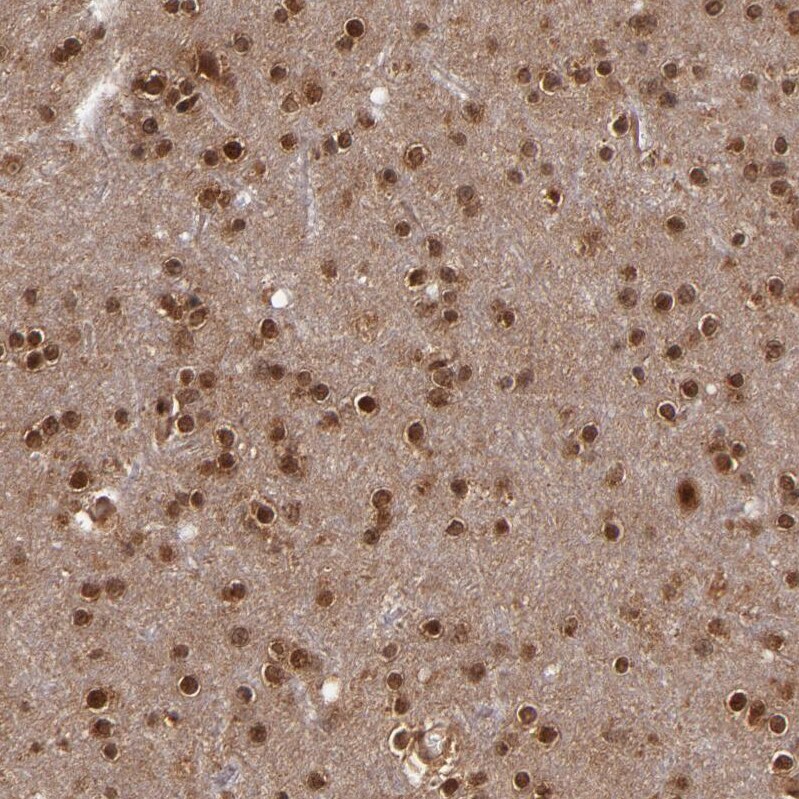Cullin 5 Antibody - BSA Free Immunohistochemistry-Paraffin: Cullin 5 Antibody - BSA Free [NBP1-86868]