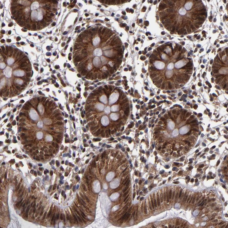 Cullin 5 Antibody - BSA Free Immunohistochemistry-Paraffin: Cullin 5 Antibody - BSA Free [NBP1-86868]