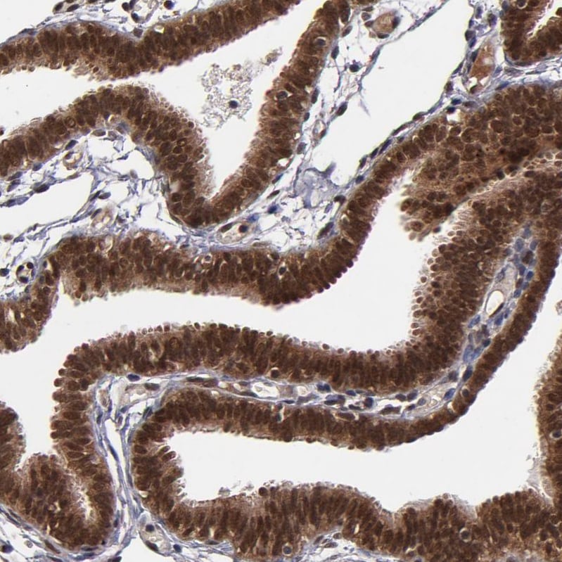 Cullin 5 Antibody - BSA Free Immunohistochemistry-Paraffin: Cullin 5 Antibody - BSA Free [NBP1-86868]