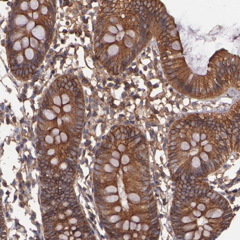Tropomodulin 3 Antibody - BSA Free Immunohistochemistry-Paraffin: Tropomodulin 3 Antibody - BSA Free [NBP1-86870]