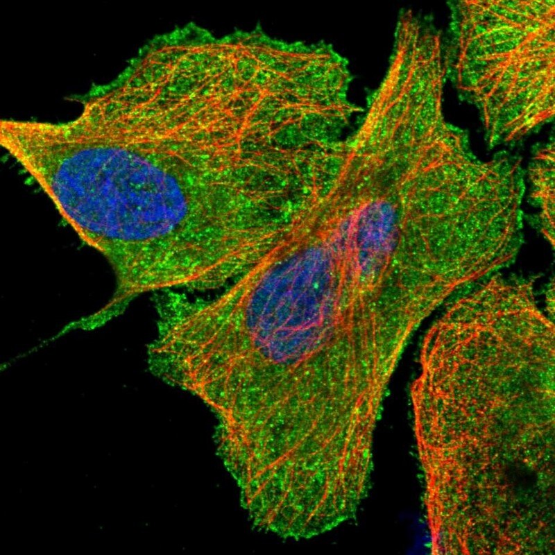 USP21 Antibody - BSA Free Immunocytochemistry/ Immunofluorescence: USP21 Antibody [NBP1-86871]