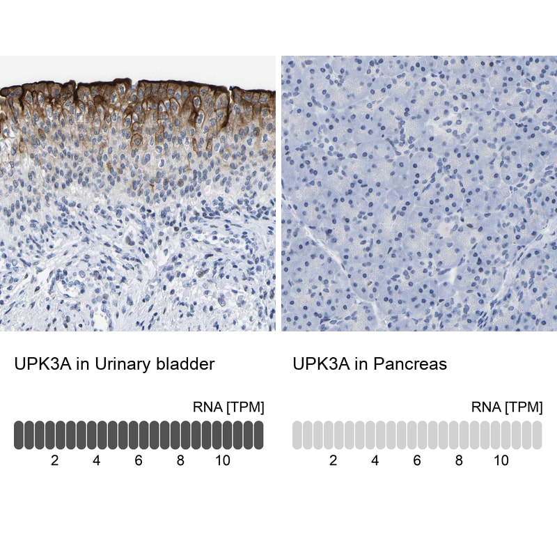 Uroplakin III Antibody - BSA Free Immunohistochemistry-Paraffin: Uroplakin III Antibody - BSA Free [NBP1-86873]