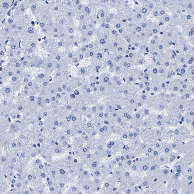 Uroplakin III Antibody - BSA Free Immunohistochemistry-Paraffin: Uroplakin III Antibody - BSA Free [NBP1-86873]