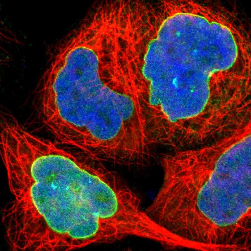 NSUN2 Antibody Immunocytochemistry/ Immunofluorescence: NSUN2 Antibody [NBP1-86878]