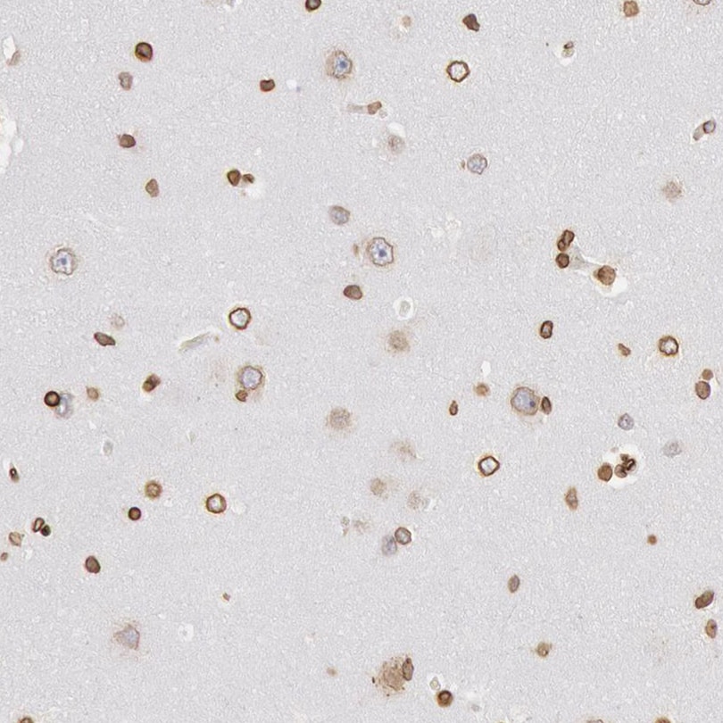 NSUN2 Antibody Immunohistochemistry-Paraffin: NSUN2 Antibody [NBP1-86878]
