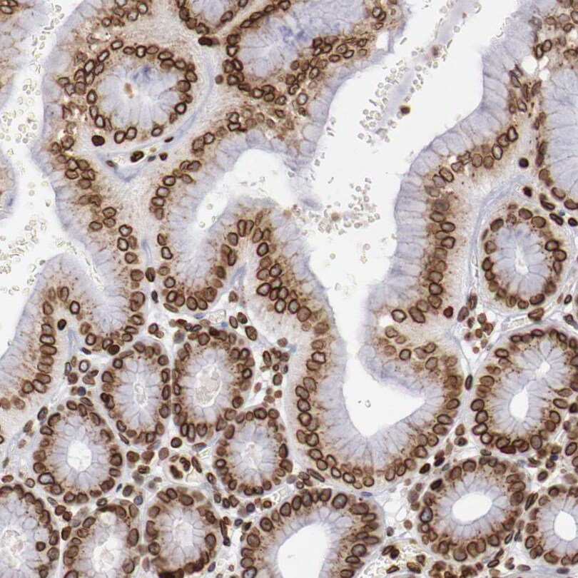 NSUN2 Antibody Immunohistochemistry-Paraffin: NSUN2 Antibody [NBP1-86878]