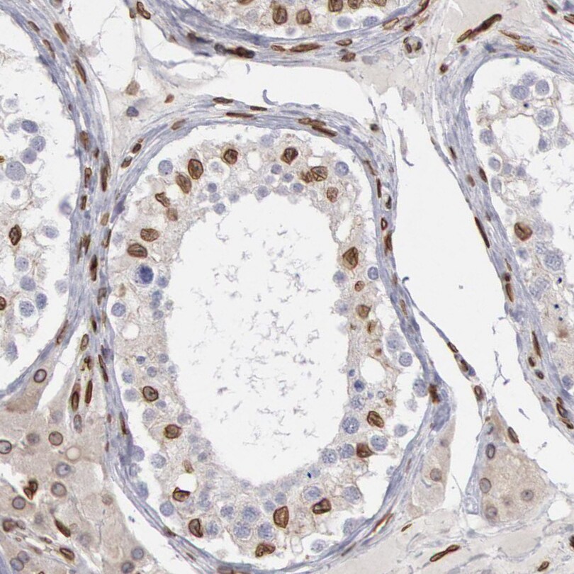 NSUN2 Antibody Immunohistochemistry-Paraffin: NSUN2 Antibody [NBP1-86878]