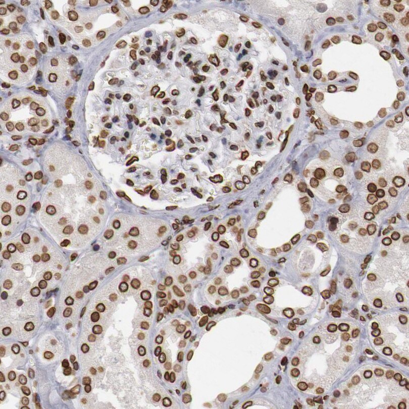 NSUN2 Antibody Immunohistochemistry-Paraffin: NSUN2 Antibody [NBP1-86878]