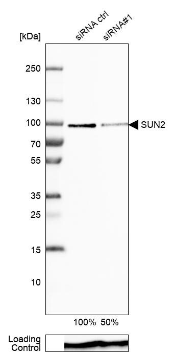 NSUN2 Antibody Western Blot: NSUN2 Antibody [NBP1-86878]