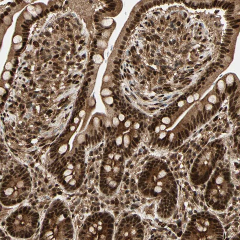 ZNF446 Antibody Immunohistochemistry: ZNF446 Antibody [NBP1-80593]