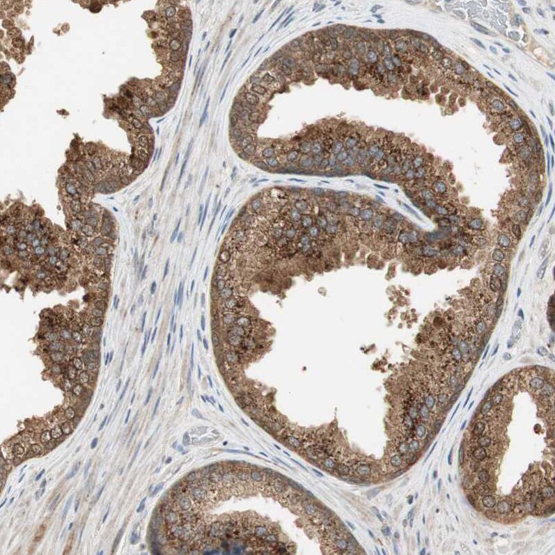 USP2 Antibody - BSA Free Immunohistochemistry-Paraffin: USP2 Antibody [NBP1-86882]