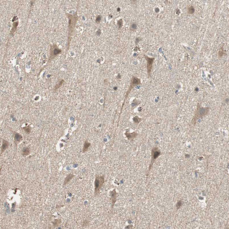 USP2 Antibody - BSA Free Immunohistochemistry-Paraffin: USP2 Antibody [NBP1-86882]