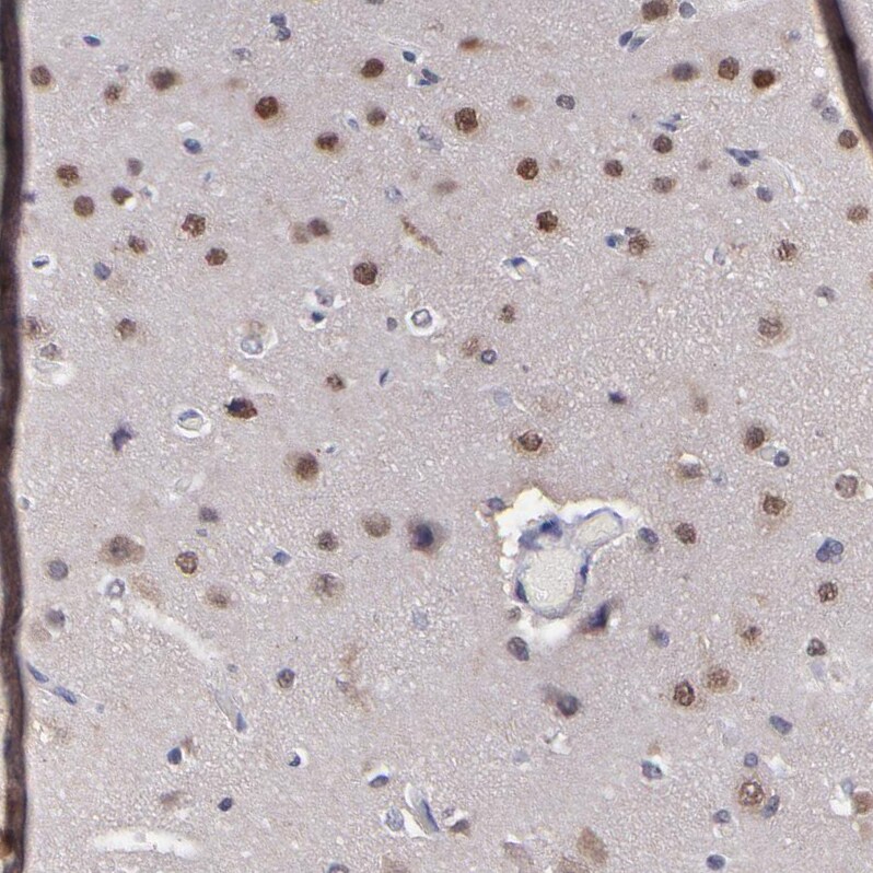 UBE2E3 Antibody - BSA Free Immunohistochemistry-Paraffin: UBE2E3 Antibody - BSA Free [NBP1-86884]