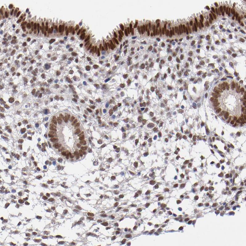 UBE2E3 Antibody - BSA Free Immunohistochemistry-Paraffin: UBE2E3 Antibody - BSA Free [NBP1-86884]