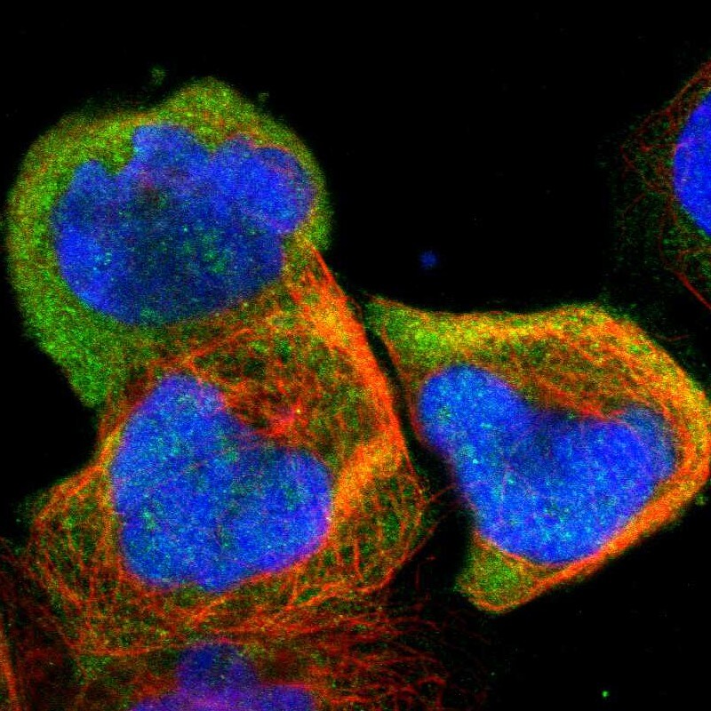 UbcH8/Ube2L6 Antibody - BSA Free Immunohistochemistry-Paraffin: UbcH8/Ube2L6 Antibody - BSA Free [NBP1-86885]