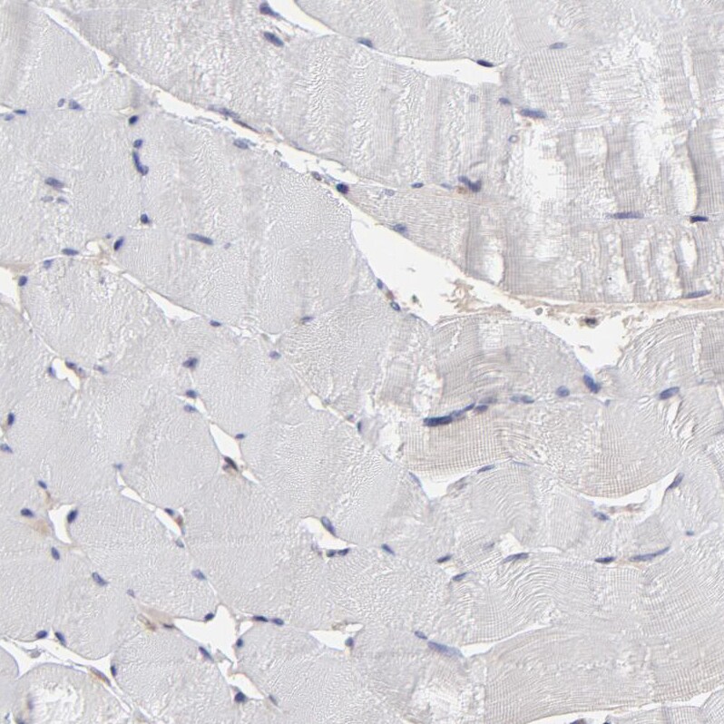 UbcH8/Ube2L6 Antibody - BSA Free Immunohistochemistry-Paraffin: UbcH8/Ube2L6 Antibody - BSA Free [NBP1-86885]