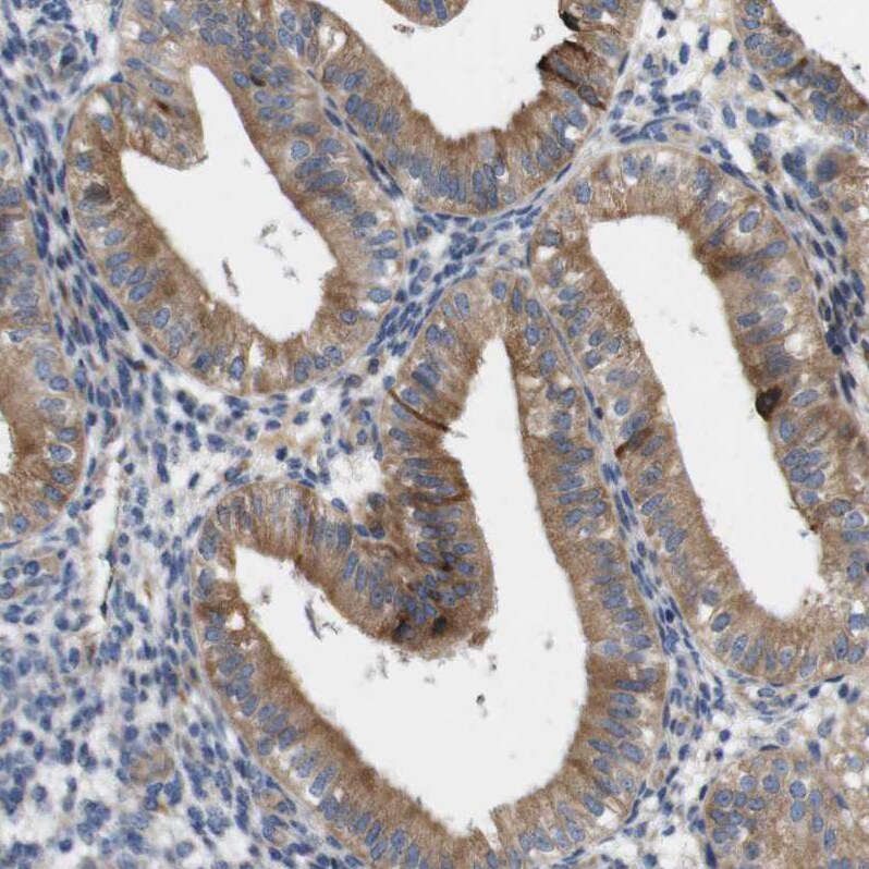 UBE2G2 Antibody - BSA Free Immunohistochemistry-Paraffin: UBE2G2 Antibody - BSA Free [NBP1-86888]