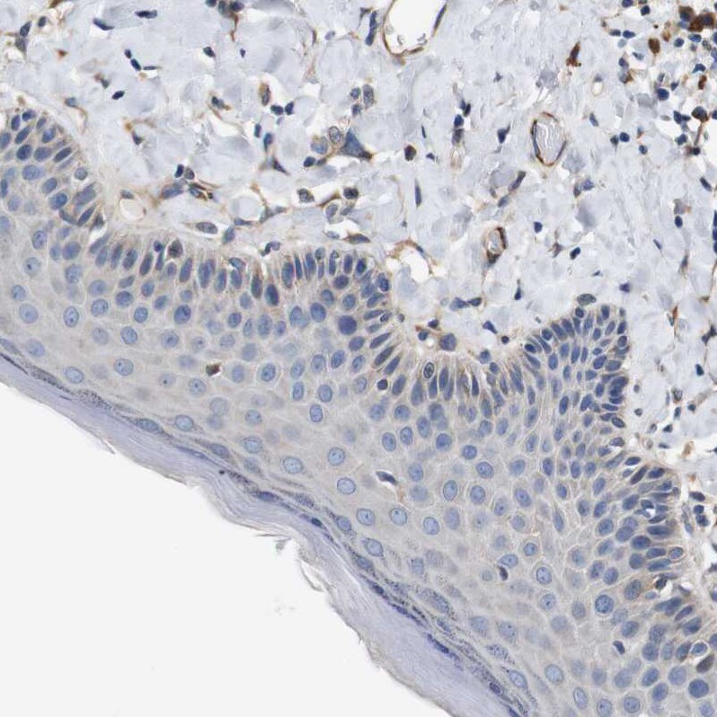 UBE2G2 Antibody - BSA Free Immunohistochemistry-Paraffin: UBE2G2 Antibody - BSA Free [NBP1-86888]
