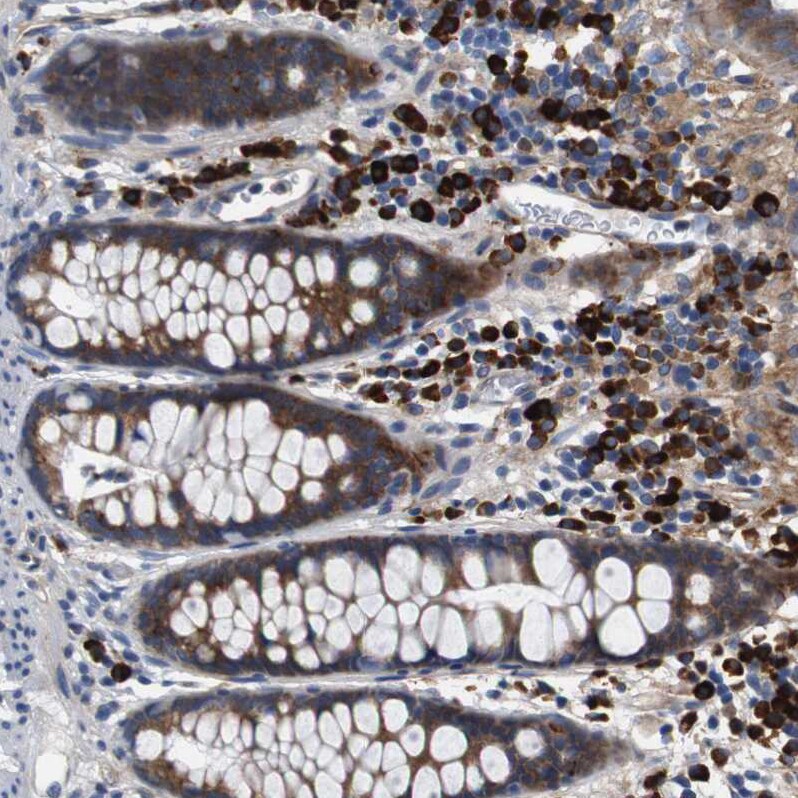 UBE2G2 Antibody - BSA Free Immunohistochemistry-Paraffin: UBE2G2 Antibody - BSA Free [NBP1-86888]
