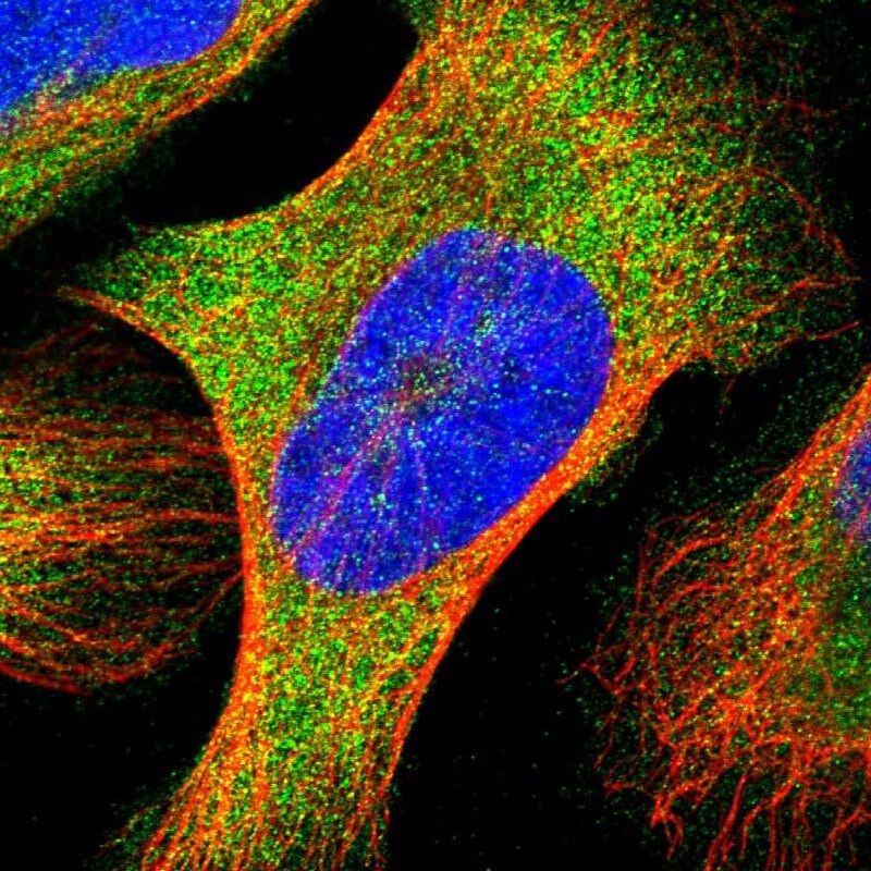 YARS Antibody - BSA Free Immunocytochemistry/ Immunofluorescence: YARS Antibody [NBP1-86889]