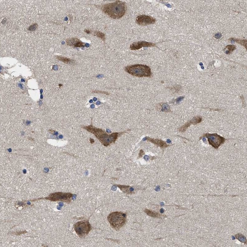 YARS Antibody - BSA Free Immunohistochemistry-Paraffin: YARS Antibody - BSA Free [NBP1-86890]