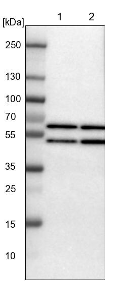 YARS Antibody - BSA Free Western Blot: YARS Antibody - BSA Free [NBP1-86890]