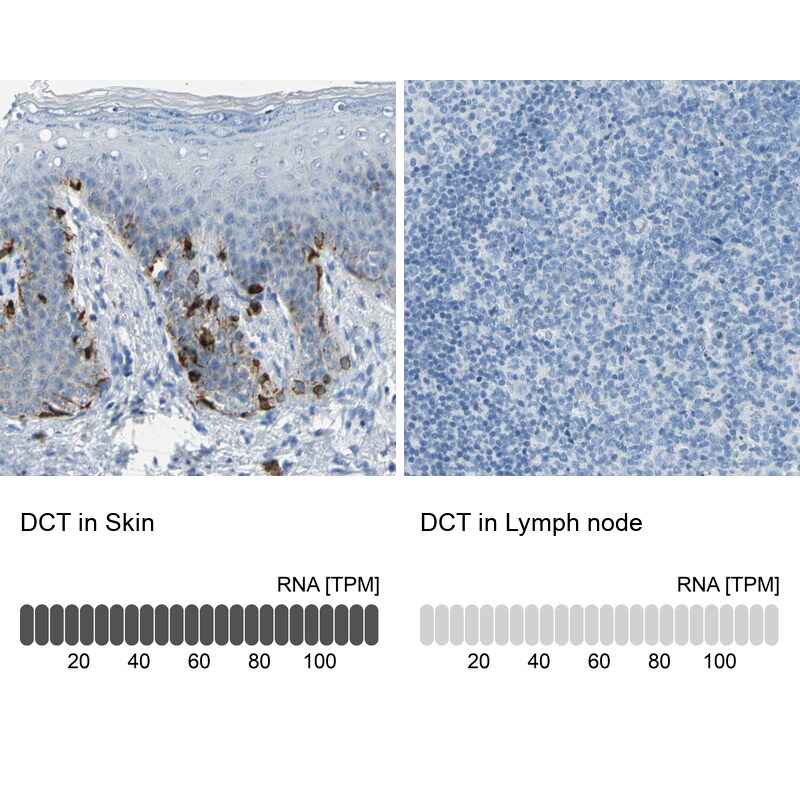 TRP2 Antibody - BSA Free Immunohistochemistry-Paraffin: TRP2 Antibody - BSA Free [NBP1-86893]