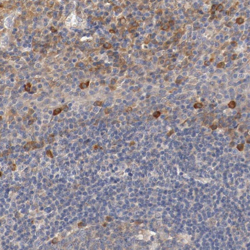 TNFSF12-TNFSF13 Antibody Immunohistochemistry-Paraffin: p63/TP73L Antibody [NBP1-86895]