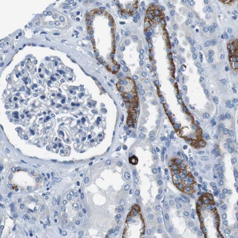TULP3 Antibody - BSA Free Immunohistochemistry-Paraffin: TULP3 Antibody - BSA Free [NBP1-86897]