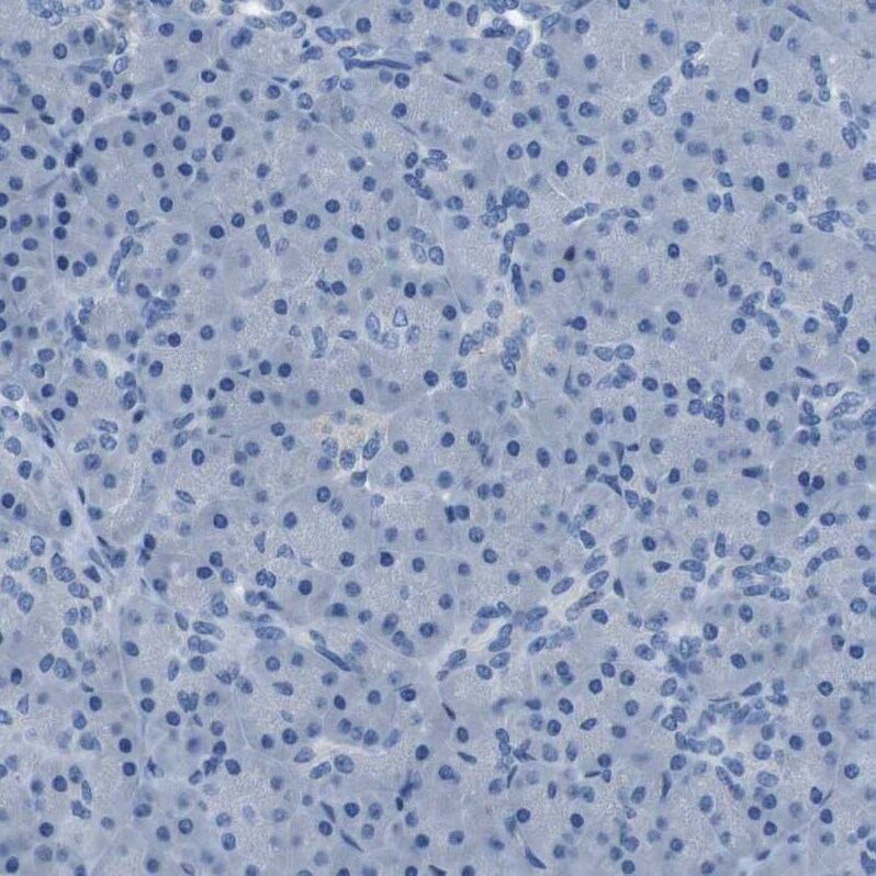 TULP3 Antibody - BSA Free Immunohistochemistry-Paraffin: TULP3 Antibody - BSA Free [NBP1-86897]