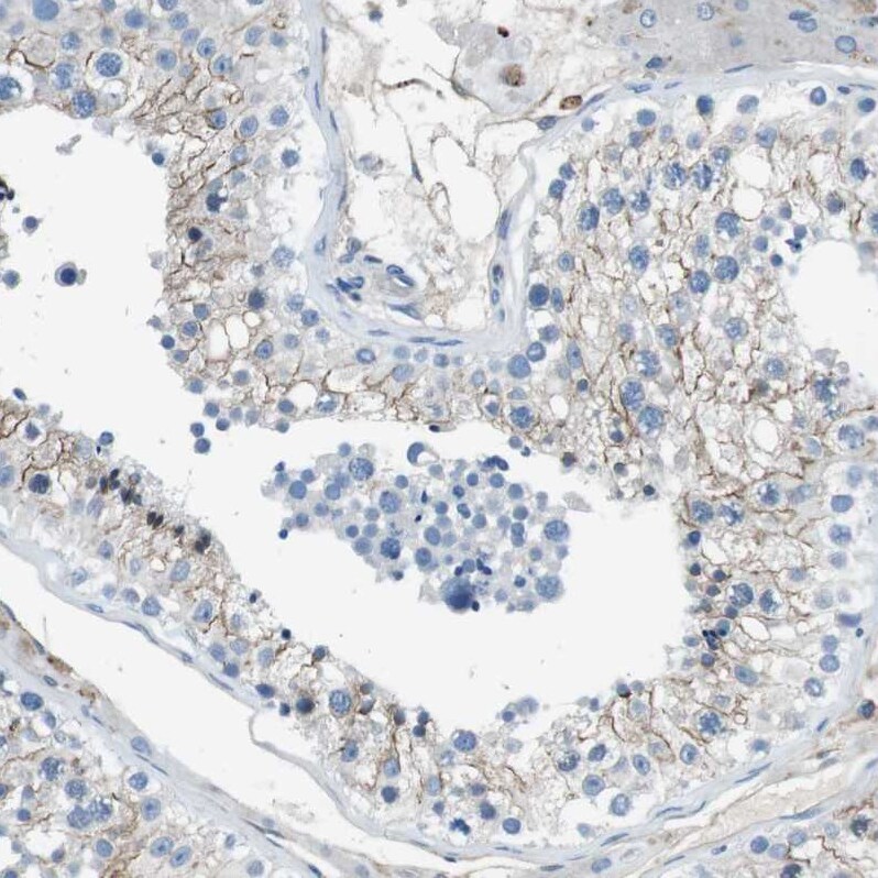 TULP3 Antibody - BSA Free Immunohistochemistry-Paraffin: TULP3 Antibody - BSA Free [NBP1-86897]