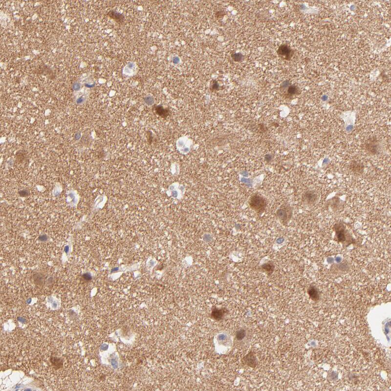 TXNL1 Antibody - BSA Free Immunohistochemistry-Paraffin: TXNL1 Antibody - BSA Free [NBP1-86899]