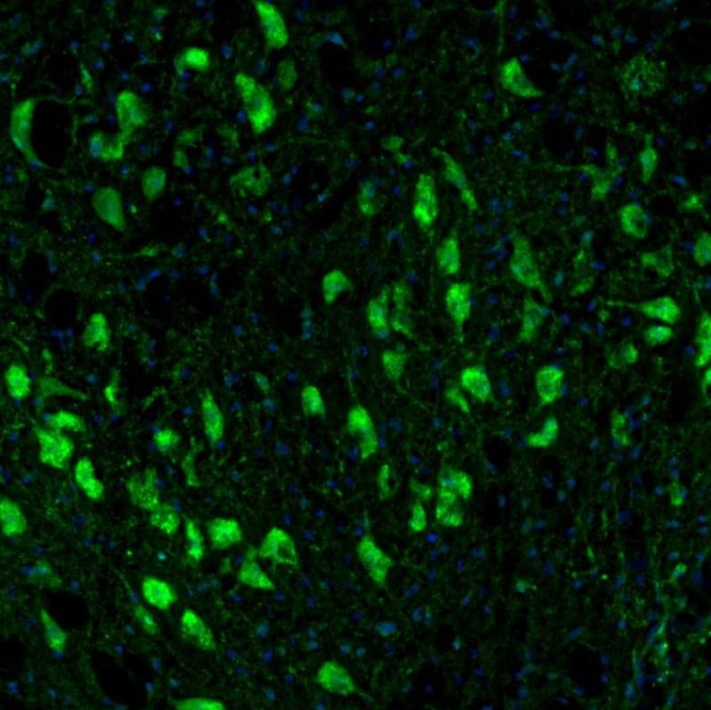 TXNL1 Antibody - BSA Free Immunohistochemistry-Paraffin: TXNL1 Antibody - BSA Free [NBP1-86899]