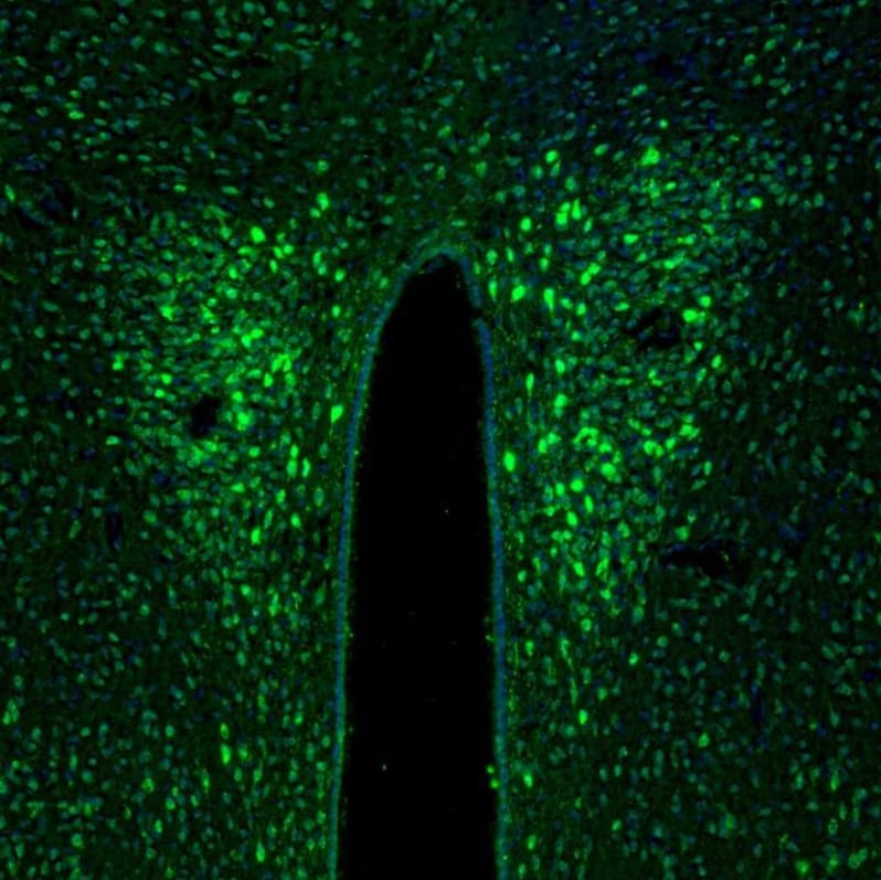 TXNL1 Antibody - BSA Free Immunohistochemistry-Paraffin: TXNL1 Antibody - BSA Free [NBP1-86899]