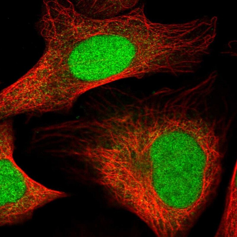 HMGN3/TRIP7 Antibody - BSA Free Immunohistochemistry-Paraffin: HMGN3/TRIP7 Antibody - BSA Free [NBP1-86904]