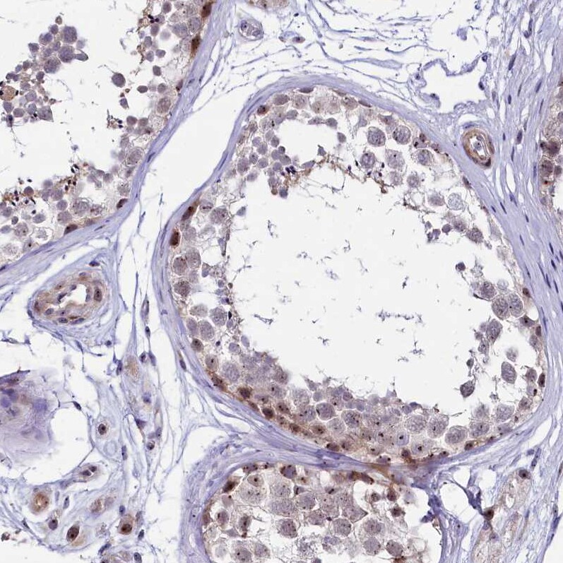 Treacher Collins syndrome protein Antibody - BSA Free Immunohistochemistry-Paraffin: Treacher Collins syndrome protein Antibody [NBP1-86908]