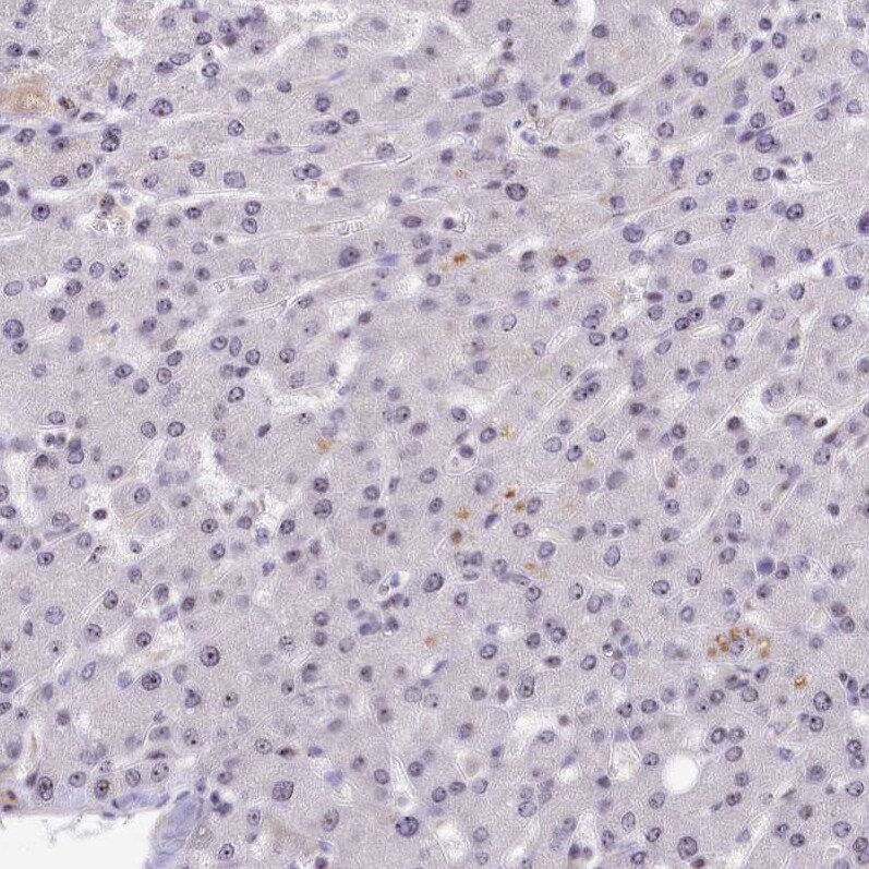 Treacher Collins syndrome protein Antibody - BSA Free Immunohistochemistry-Paraffin: Treacher Collins syndrome protein Antibody [NBP1-86908]
