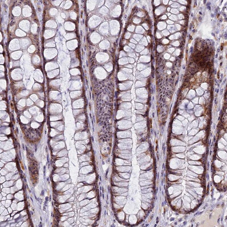 Treacher Collins syndrome protein Antibody - BSA Free Immunohistochemistry-Paraffin: Treacher Collins syndrome protein Antibody [NBP1-86908]