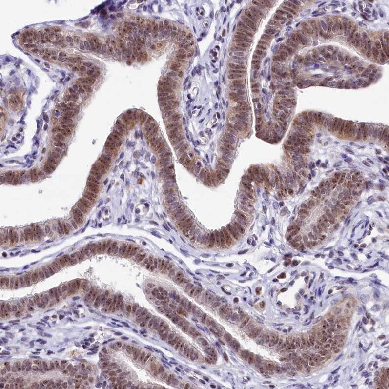 Treacher Collins syndrome protein Antibody - BSA Free Immunohistochemistry-Paraffin: Treacher Collins syndrome protein Antibody [NBP1-86908]