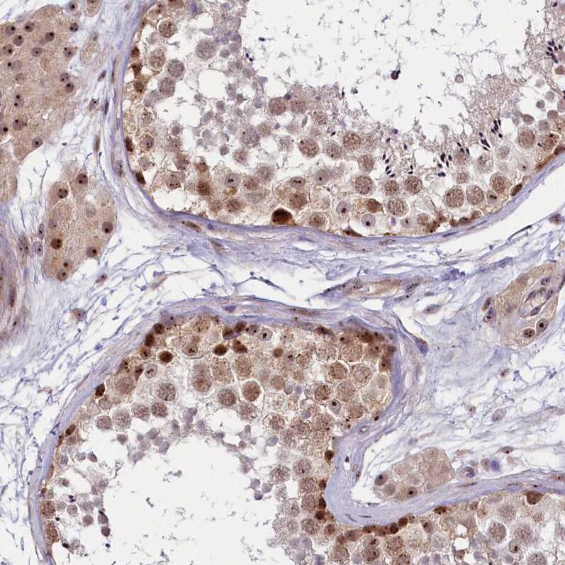 Treacher Collins syndrome protein Antibody - BSA Free Immunohistochemistry-Paraffin: Treacher Collins syndrome protein Antibody [NBP1-86909]