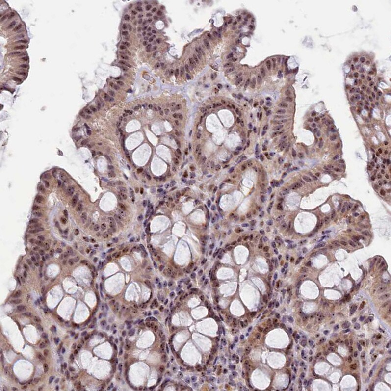 Treacher Collins syndrome protein Antibody - BSA Free Immunohistochemistry-Paraffin: Treacher Collins syndrome protein Antibody [NBP1-86909]