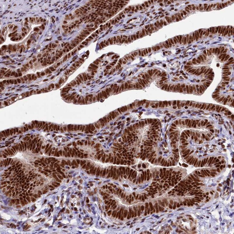 Treacher Collins syndrome protein Antibody - BSA Free Immunohistochemistry-Paraffin: Treacher Collins syndrome protein Antibody [NBP1-86909]