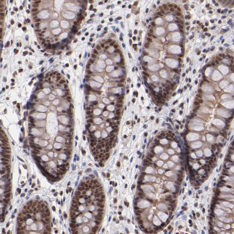 TRF-2 Antibody - BSA Free Immunohistochemistry-Paraffin: TRF-2 Antibody - BSA Free [NBP1-86910]