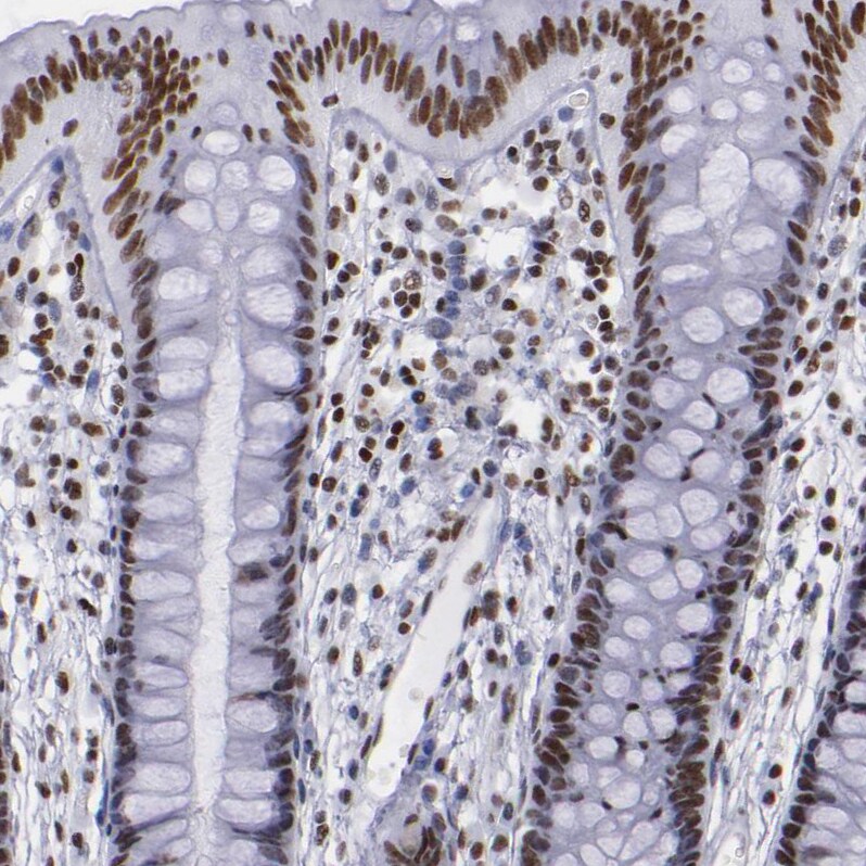 TRF-2 Antibody - BSA Free Immunohistochemistry-Paraffin: TRF-2 Antibody - BSA Free [NBP1-86911]